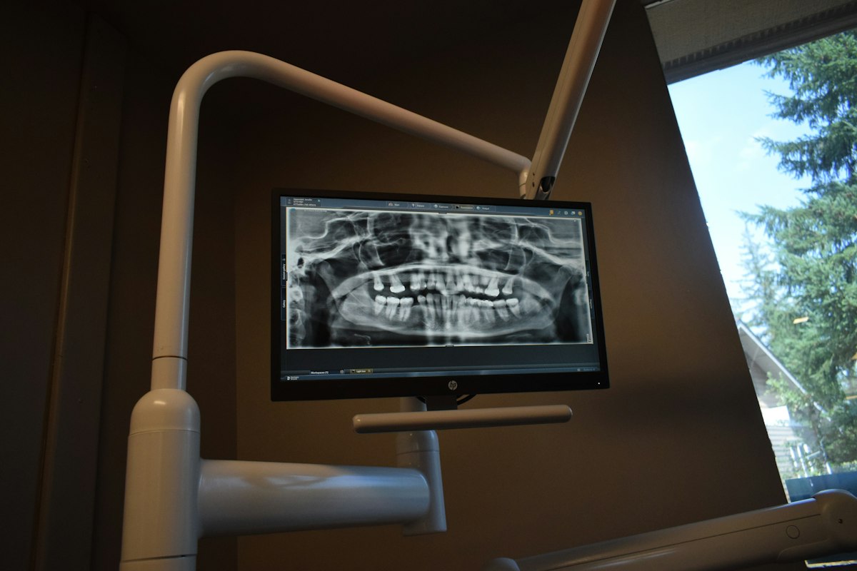 AI-generated 3D dental crown model in CAD software